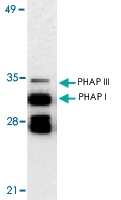 PAB13112 - ANP32A