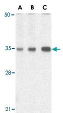 PAB13113 - TIRAP