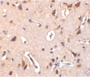 PAB13114 - STRAD beta / ILPIP