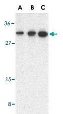 PAB13115 - STRAD beta / ILPIP