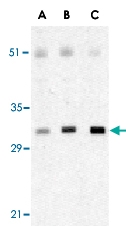 PAB13116 - XAF1