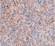 PAB13116 - XAF1