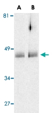 PAB13117 - HTRA2 / PRSS25