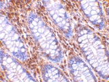 PAB13117 - HTRA2 / PRSS25