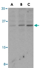 PAB13118 - Bcl-2