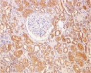 PAB13118 - Bcl-2