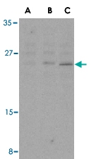 PAB13119 - Bcl-2