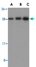 PAB13120 - BID