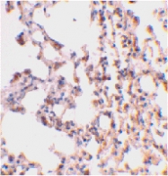 PAB13120 - BID