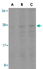 PAB13121 - BID