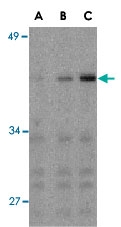PAB13122 - IRF3