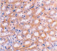 PAB13122 - IRF3
