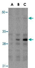 PAB13123 - IRF3