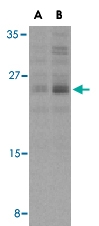 PAB13124 - Bcl-2-like 11