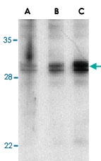 PAB13125 - XAF1