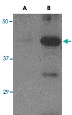 PAB13131 - Influenza A H5N1