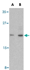 PAB13138 - Caspase-6