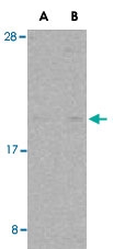 PAB13142 - RHEB