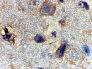 PAB13143 - RHEB