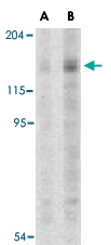 PAB13144 - TSC1 / Hamartin