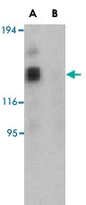 PAB13145 - TSC1 / Hamartin