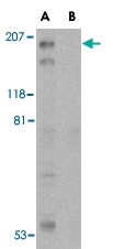 PAB13146 - TSC2 / Tuberin