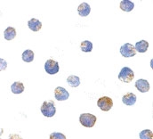 PAB13147 - TSC2 / Tuberin