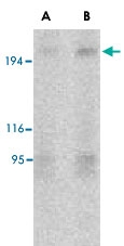 PAB13147 - TSC2 / Tuberin