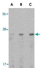 PAB13150 - Adiponectin