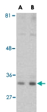 PAB13151 - C1QTNF1