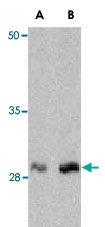PAB13152 - C1QTNF1