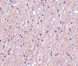 PAB13154 - C1QTNF4