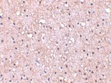 PAB13155 - C1QTNF5