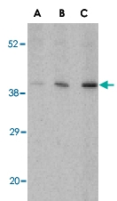 PAB13156 - C1QTNF5
