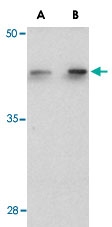 PAB13157 - C1QTNF6