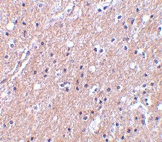 PAB13158 - C1QTNF6