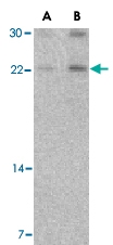 PAB13160 - Cerebellin-1