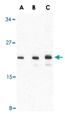 PAB13165 - AES / ESP1