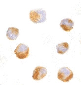 PAB13166 - AES / ESP1