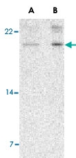 PAB13166 - AES / ESP1