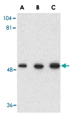 PAB13171 - GOPC / PIST