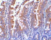PAB13171 - GOPC / PIST