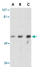 PAB13172 - GOPC / PIST