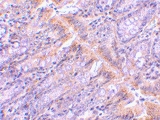 PAB13172 - GOPC / PIST