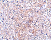 PAB13174 - TRAF2 / TRAP3