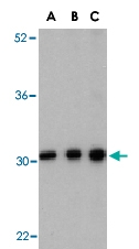 PAB13175 - BCAP31 / BAP31