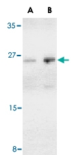 PAB13177 - BCAP29 / BAP29