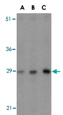 PAB13178 - BCAP31 / BAP31