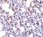PAB13178 - BCAP31 / BAP31