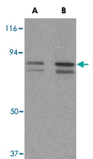 PAB13179 - ATF6 alpha